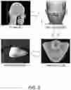 Fig. 05 - Multi-layer skin substitute products and methods of making and using the same