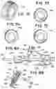 Fig. 06 - ASPIRATION CONTROL VALVE