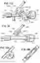 Fig. 10 - ASPIRATION CONTROL VALVE