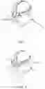 Fig. 07 - SURGICAL SMOKE REMOVING DEVICE