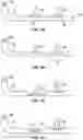 Fig. 03 - BREAST PUMP ASSEMBLY