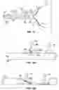 Fig. 11 - BREAST PUMP ASSEMBLY