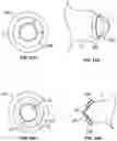 Fig. 20 - BREAST PUMP ASSEMBLY