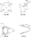 Fig. 24 - BREAST PUMP ASSEMBLY