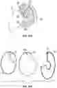 Fig. 34 - BREAST PUMP ASSEMBLY