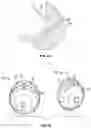 Fig. 49 - BREAST PUMP ASSEMBLY