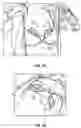 Fig. 50 - BREAST PUMP ASSEMBLY