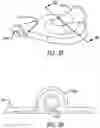 Fig. 04 - Rotary Blood Pump