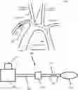 Fig. 01 - Predictive QRS detection and R-to-R timing systems and methods