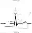 Fig. 07 - PREDICTIVE QRS DETECTION AND R-TO-R TIMING SYSTEMS AND METHODS