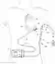 Fig. 01 - Energy management of blood pump controllers