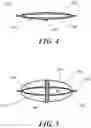 Fig. 04 - PRESSURE INFUSION DEVICE FOR RETAINING INFUSION BAG AND ADJUSTABLE GRAVITY-INDEPENDENT OPERATION THEREOF