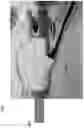 Fig. 04 - Surgical Insufflation Systems and Methods for Use
