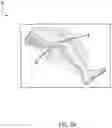 Fig. 06 - Surgical Insufflation Systems and Methods for Use