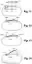 Fig. 10 - Aerosol provision system and removable member