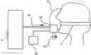 Fig. 01 - Process and device for ventilating a patient