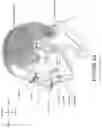 Fig. 08 - Oro-nasal patient interface