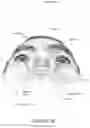 Fig. 10 - Oro-nasal patient interface
