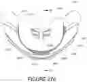 Fig. 136 - Oro-nasal patient interface