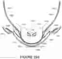 Fig. 146 - Oro-nasal patient interface