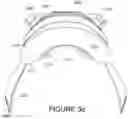 Fig. 18 - Oro-nasal patient interface