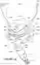 Fig. 20 - Oro-nasal patient interface