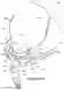 Fig. 25 - Oro-nasal patient interface