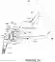 Fig. 27 - Oro-nasal patient interface