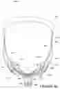 Fig. 28 - Oro-nasal patient interface