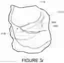 Fig. 30 - Oro-nasal patient interface