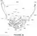 Fig. 31 - Oro-nasal patient interface