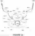 Fig. 33 - Oro-nasal patient interface