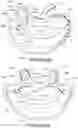 Fig. 46 - Oro-nasal patient interface