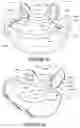 Fig. 47 - Oro-nasal patient interface