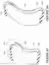 Fig. 51 - Oro-nasal patient interface