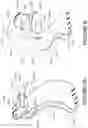 Fig. 53 - Oro-nasal patient interface