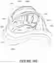 Fig. 65 - Oro-nasal patient interface