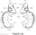 Fig. 72 - Oro-nasal patient interface
