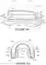 Fig. 74 - Oro-nasal patient interface