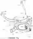 Fig. 75 - Oro-nasal patient interface