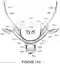 Fig. 77 - Oro-nasal patient interface