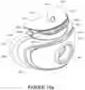 Fig. 80 - Oro-nasal patient interface