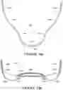 Fig. 88 - Oro-nasal patient interface