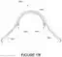 Fig. 89 - Oro-nasal patient interface
