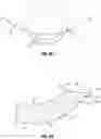 Fig. 04 - INTRAVASCULAR DEVICE WITH ENHANCED ONE-BEAM CUT PATTERN