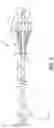 Fig. 03 - Catheter including expandable member