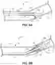 Fig. 10 - Catheter including expandable member