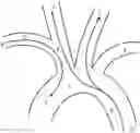 Fig. 01 - Transradial Access Systems Particularly Useful for Cerebral Access