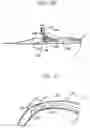 Fig. 18 - ANCHOR DEPLOYMENT DEVICES AND RELATED METHODS