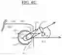 Fig. 34 - ANCHOR DEPLOYMENT DEVICES AND RELATED METHODS